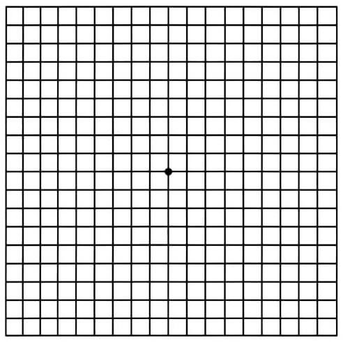 Amsler Grid Example