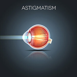 Astigmatism Diagram