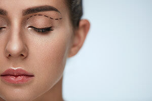 Closeup of a Woman Being Prepped For Eyelid Surgery